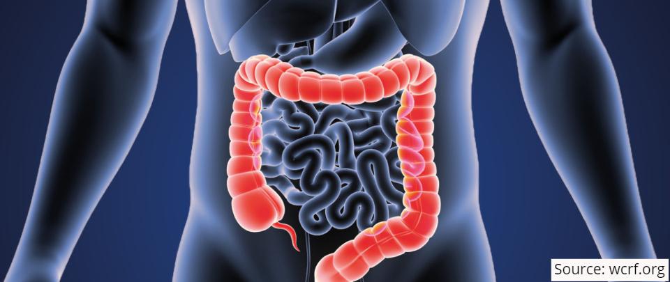 Preventing & Treating Recurrence of Colorectal Cancer
